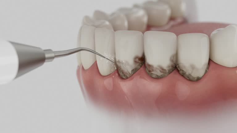 Reliable Dental contractor in Remington, IN by Dentist Open Now